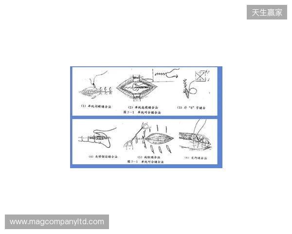 广州豹官方:杨浩眉弓伤口缝合30余针,预计5-7天后拆线